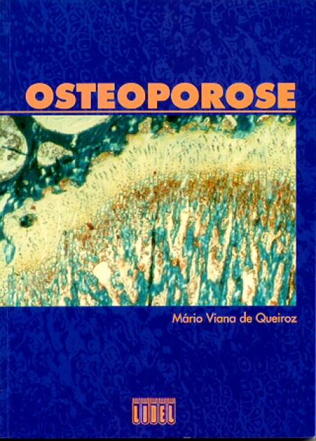 OSTEOPOROSE - Importancia da osteoporose - celulas osseas - metabolismo fosto-calcio - menopausa - epidemiologia - fisiologia e causas - nutrição exercicio -